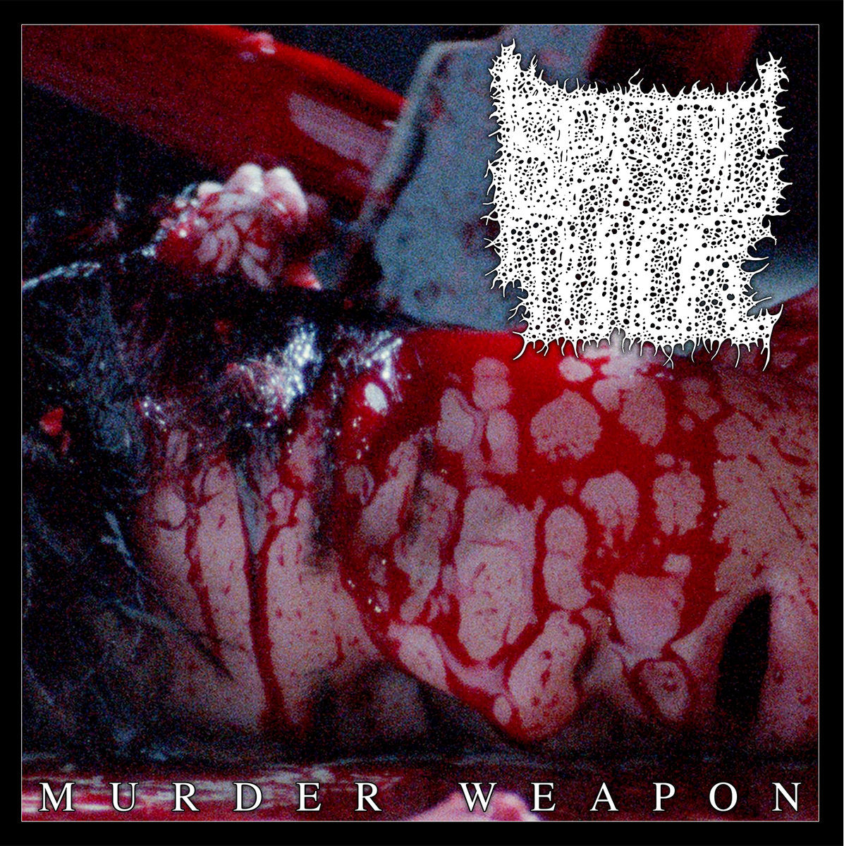 Spastic Tumor "Murder Weapon" TAPE