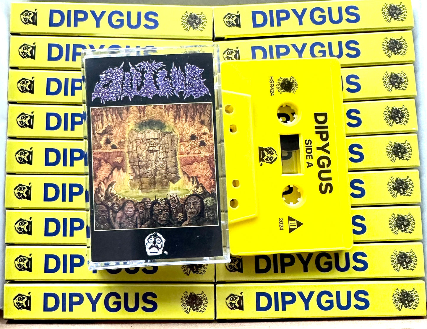 Dipygus "Dipygus" TAPE