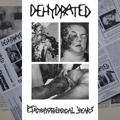 Dehydrated "Psychopathological Years" TAPE