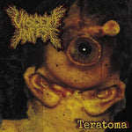 Viscera Infest "Teratoma" TAPE