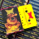 Viscera Infest "Teratoma" TAPE